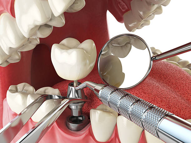 Best Emergency Dental Services Near Me  in La Crescenta Montrose, CA